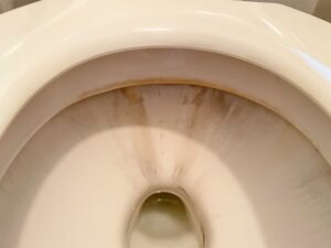 便器の汚れが気になる